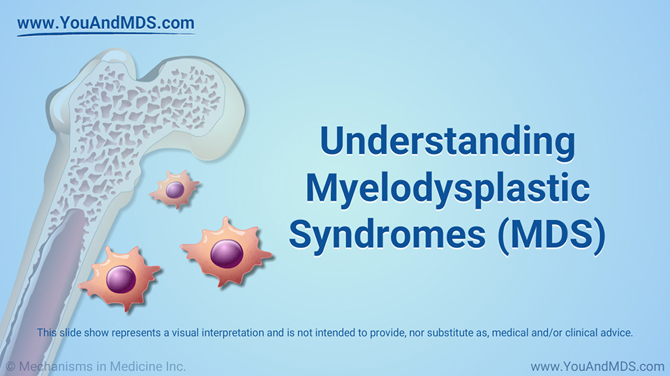 myelodysplastic syndrome diagram