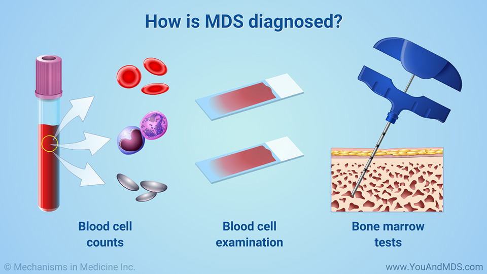 Slide Show - Diagnosis of MDS