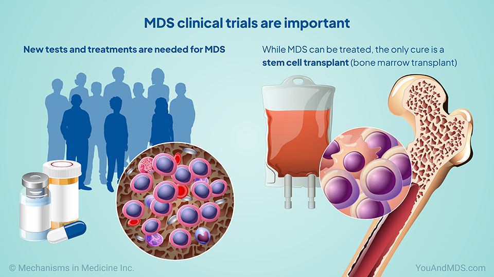 MDS clinical trials are important 